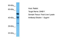 hydroxysteroid (17-beta) dehydrogenase 11 Rabbit anti-Human, Polyclonal, Novus Biologicals 0.1 mL | Buy Online | Novus Biologicals | Fisher Scientific